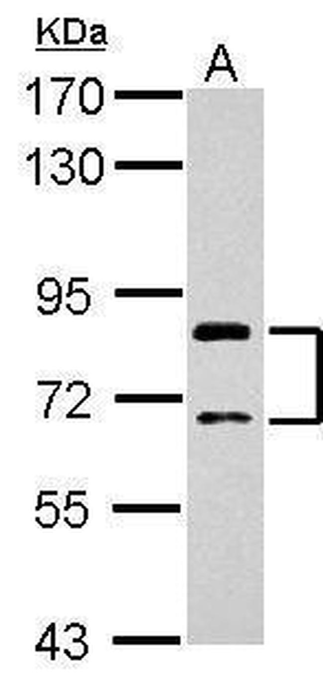 SLCO1C1 Antibody in Western Blot (WB)