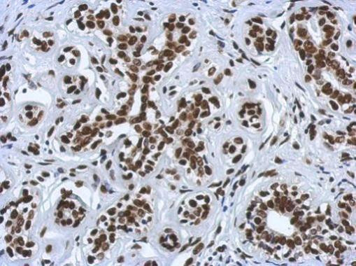 H4ac pan-acetyl (K5,K8,K12,K16) Antibody in Immunohistochemistry (Paraffin) (IHC (P))