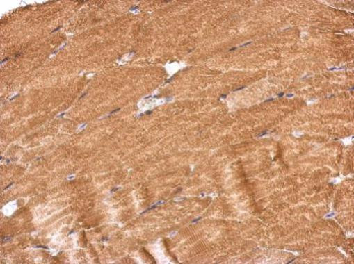 PROSC Antibody in Immunohistochemistry (Paraffin) (IHC (P))