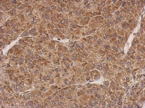 PROSC Antibody in Immunohistochemistry (Paraffin) (IHC (P))