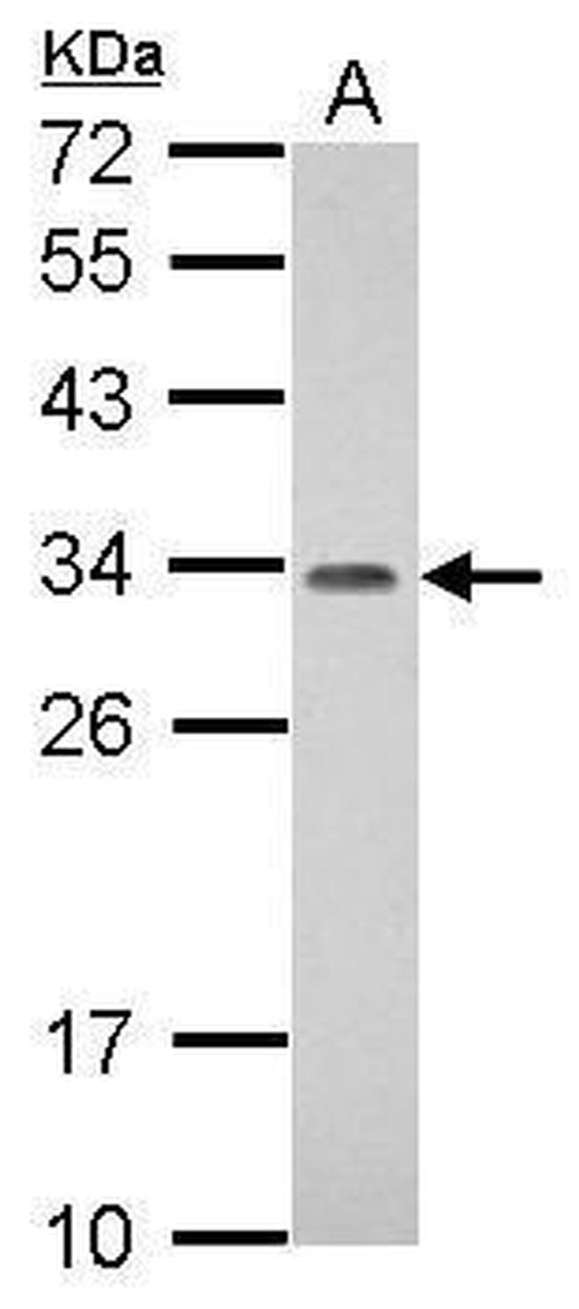 PROSC Antibody in Western Blot (WB)