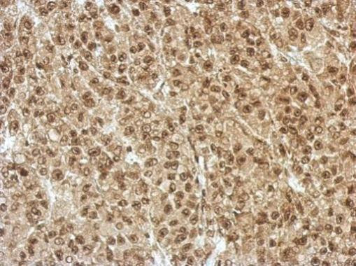 ZFAT Antibody in Immunohistochemistry (Paraffin) (IHC (P))