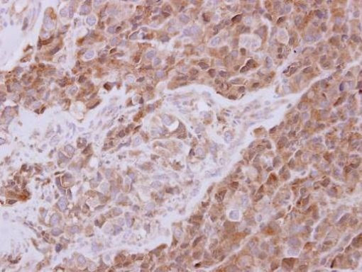 ATG13 Antibody in Immunohistochemistry (Paraffin) (IHC (P))