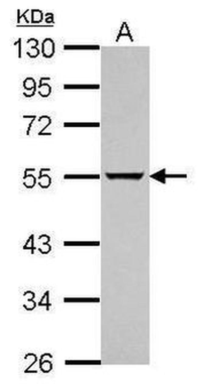 ATG13 Antibody in Western Blot (WB)