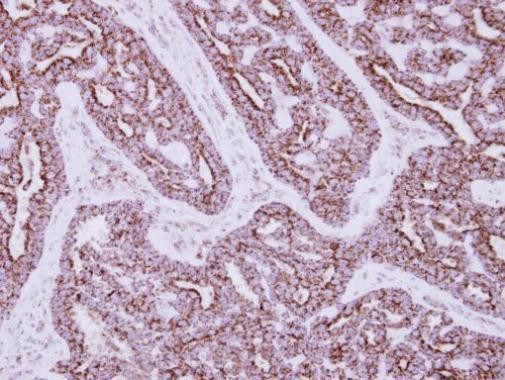 HIBADH Antibody in Immunohistochemistry (Paraffin) (IHC (P))