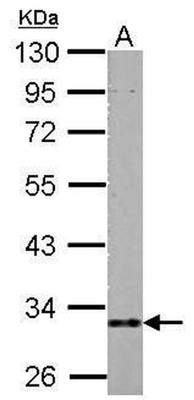 HIBADH Antibody in Western Blot (WB)