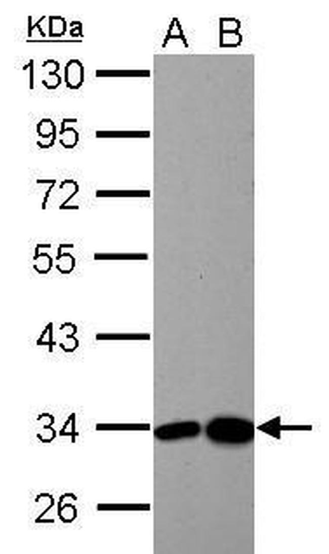 HIBADH Antibody in Western Blot (WB)