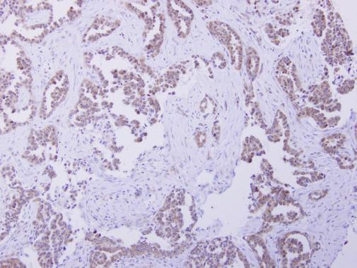 CBR4 Antibody in Immunohistochemistry (Paraffin) (IHC (P))