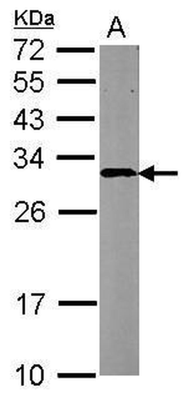 CBR4 Antibody in Western Blot (WB)