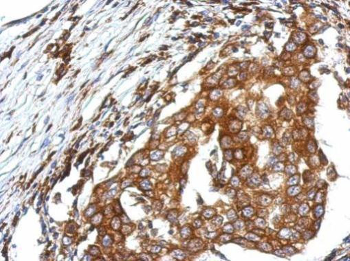 QTRTD1 Antibody in Immunohistochemistry (Paraffin) (IHC (P))