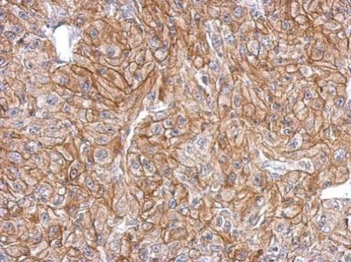 FLRT2 Antibody in Immunohistochemistry (Paraffin) (IHC (P))