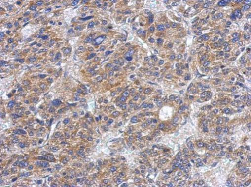 CK1 delta Antibody in Immunohistochemistry (Paraffin) (IHC (P))