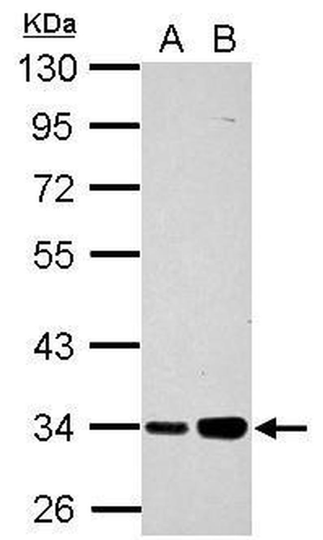 PARP16 Polyclonal Antibody (PA5-32130)