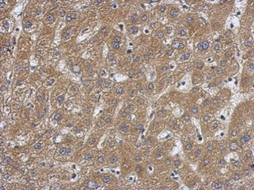 Caspase 7 p11 Antibody in Immunohistochemistry (Paraffin) (IHC (P))