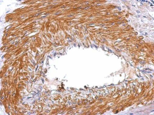 SERPINE2 Antibody in Immunohistochemistry (Paraffin) (IHC (P))