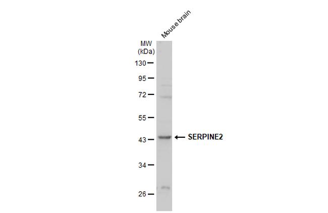 SERPINE2 Antibody in Western Blot (WB)