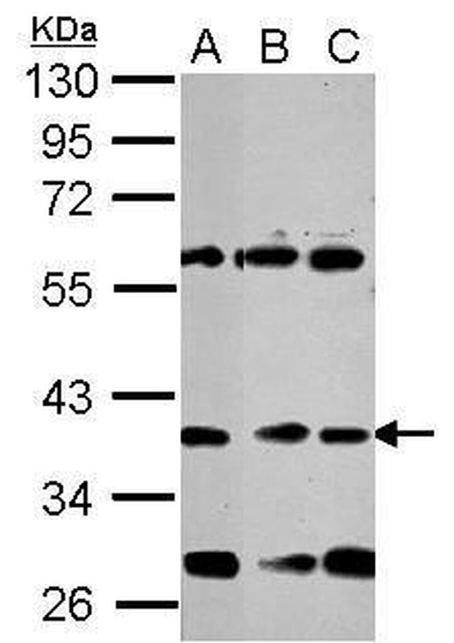 NeuroD1 Polyclonal Antibody (PA5-32204)