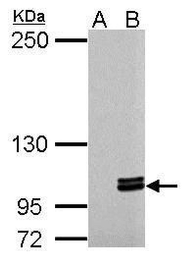 MYO1C Antibody in Western Blot (WB)