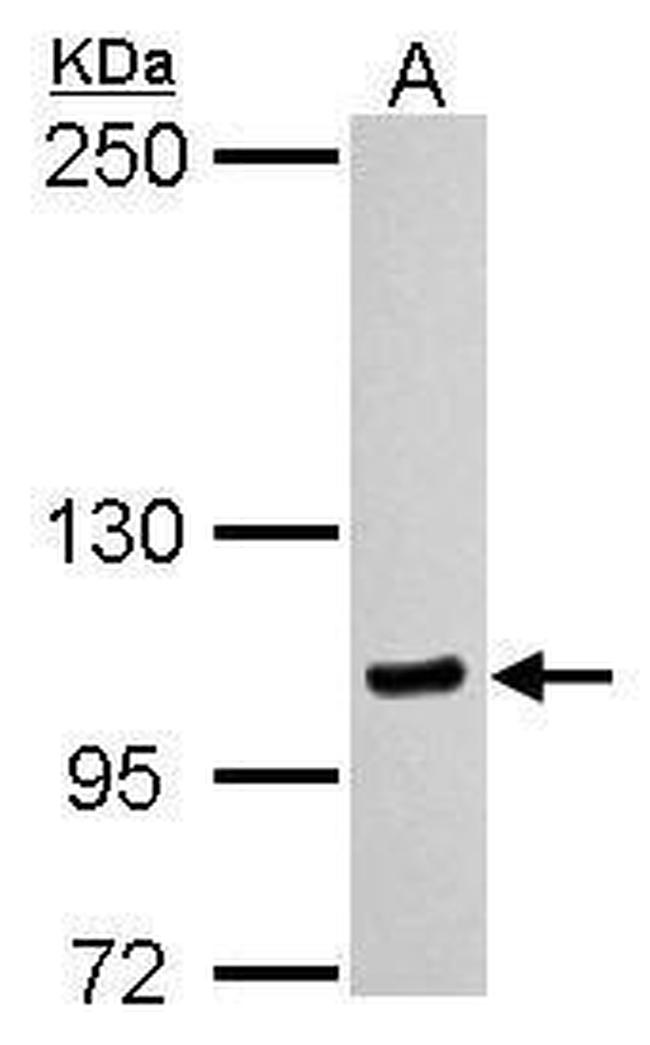 MYO1C Antibody in Western Blot (WB)