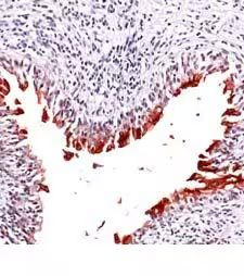 UPK3A Antibody in Immunohistochemistry (Paraffin) (IHC (P))