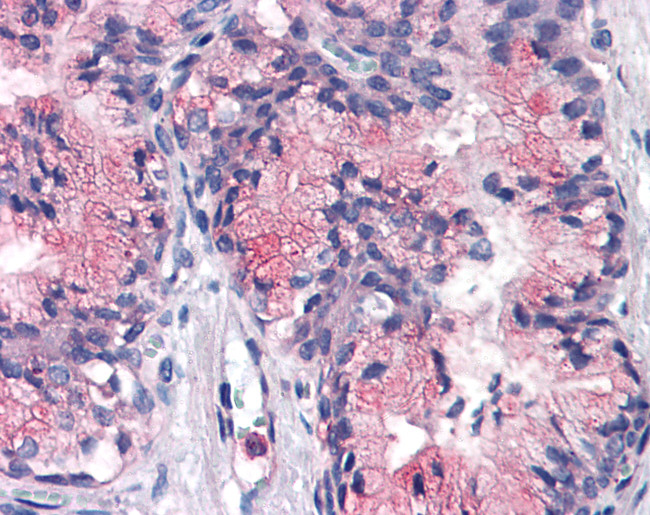 CD298 Antibody in Immunohistochemistry (Paraffin) (IHC (P))