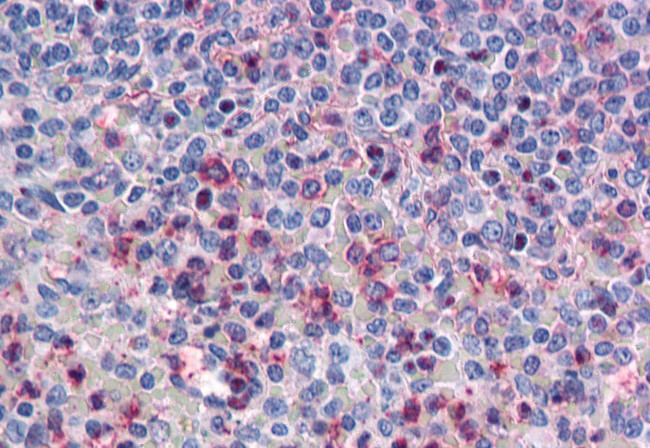 CD298 Antibody in Immunohistochemistry (Paraffin) (IHC (P))