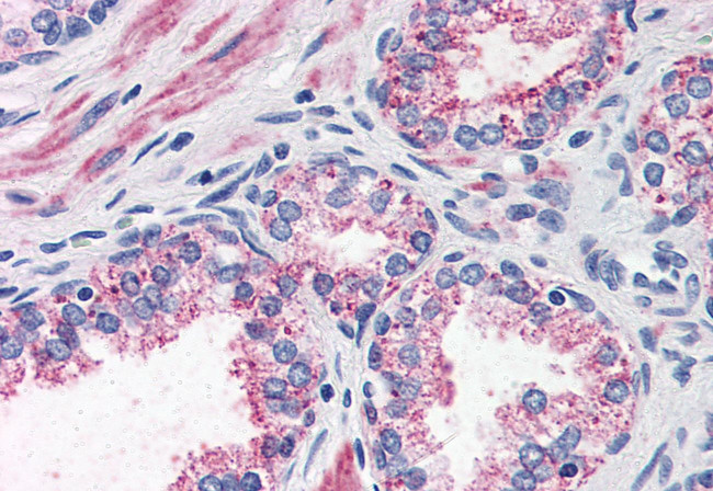 CCKAR Antibody in Immunohistochemistry (Paraffin) (IHC (P))