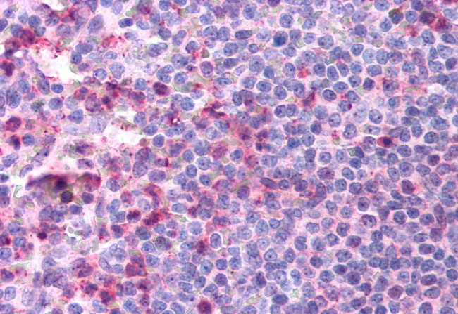 CCR4 Antibody in Immunohistochemistry (Paraffin) (IHC (P))