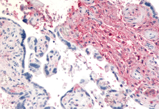 CD26 Antibody in Immunohistochemistry (Paraffin) (IHC (P))