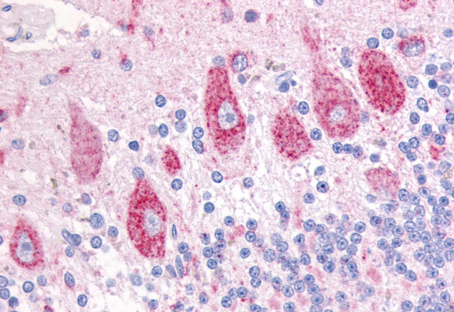 DUSP23 Antibody in Immunohistochemistry (Paraffin) (IHC (P))