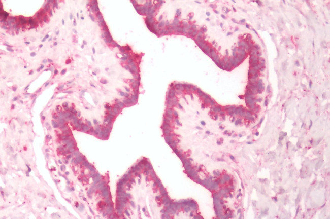 DUSP26 Antibody in Immunohistochemistry (Paraffin) (IHC (P))