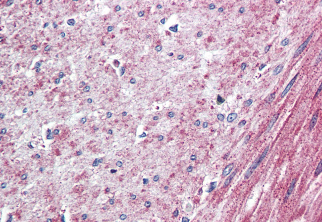 ELTD1 Antibody in Immunohistochemistry (Paraffin) (IHC (P))