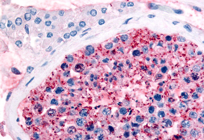 FZD9 Antibody in Immunohistochemistry (Paraffin) (IHC (P))