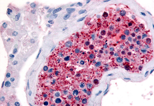 FZD9 Antibody in Immunohistochemistry (Paraffin) (IHC (P))