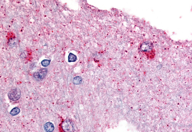 GPBB Antibody in Immunohistochemistry (Paraffin) (IHC (P))