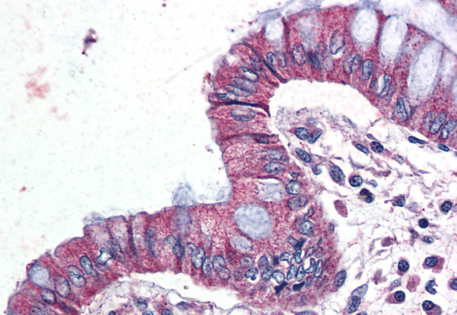 GPR116 Antibody in Immunohistochemistry (Paraffin) (IHC (P))