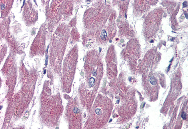 GPR116 Antibody in Immunohistochemistry (Paraffin) (IHC (P))