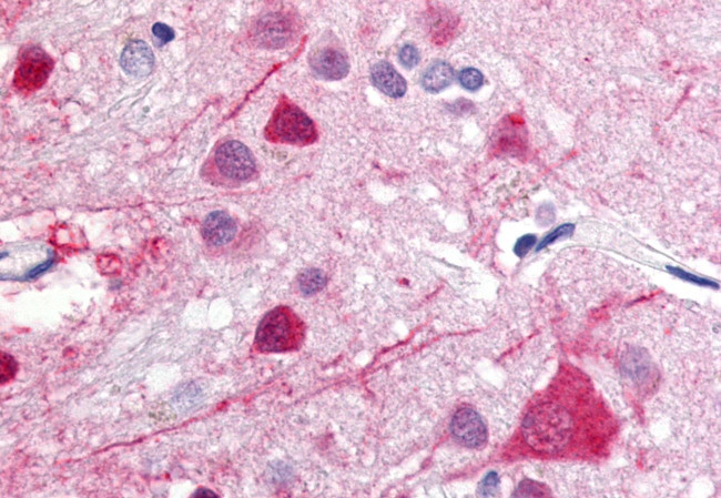 GPR52 Antibody in Immunohistochemistry (Paraffin) (IHC (P))