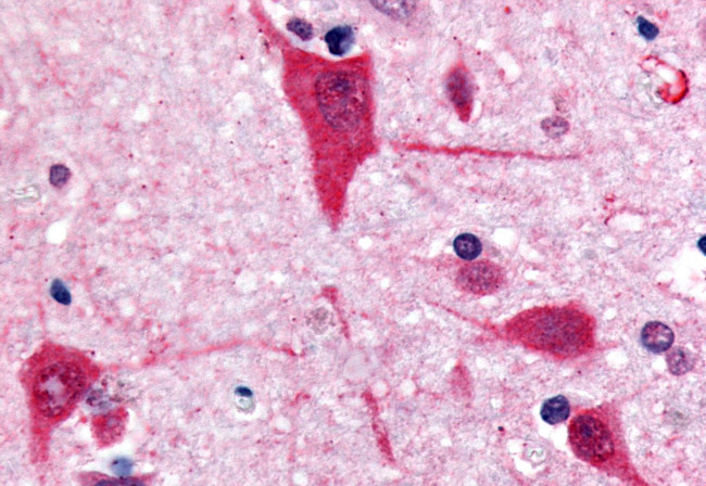 GPR61 Antibody in Immunohistochemistry (Paraffin) (IHC (P))