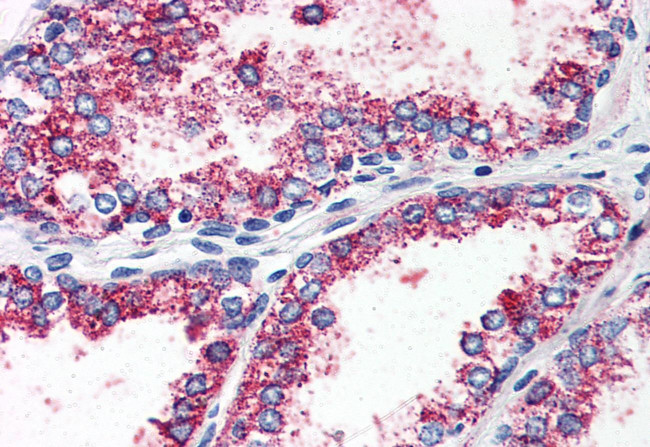 HTR2A Antibody in Immunohistochemistry (Paraffin) (IHC (P))