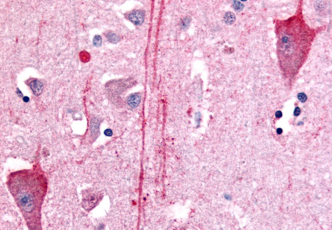 HTR7 Antibody in Immunohistochemistry (Paraffin) (IHC (P))