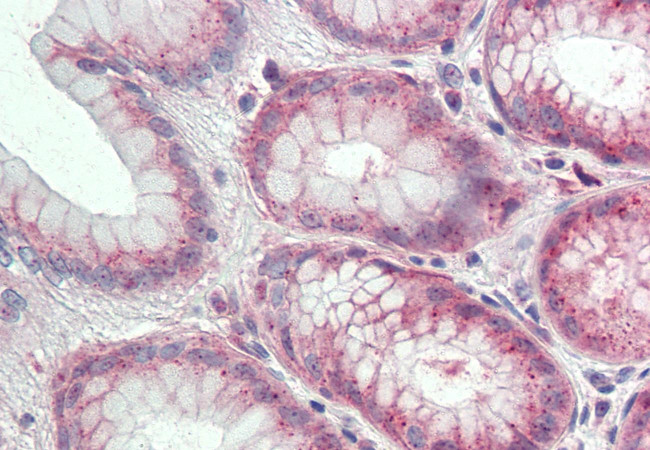 CD49f Antibody in Immunohistochemistry (Paraffin) (IHC (P))