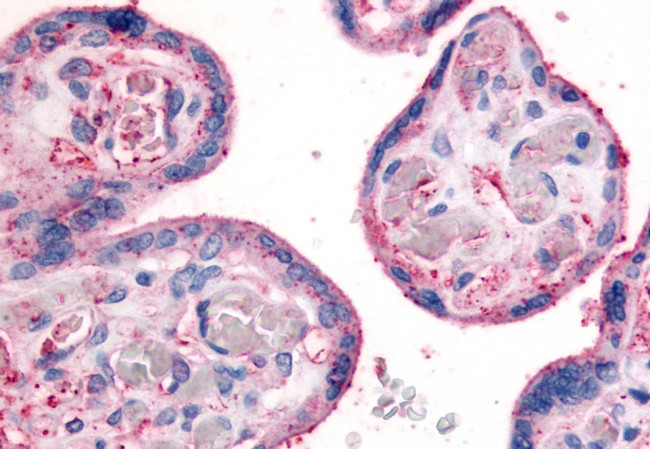 ITGB1 Antibody in Immunohistochemistry (Paraffin) (IHC (P))