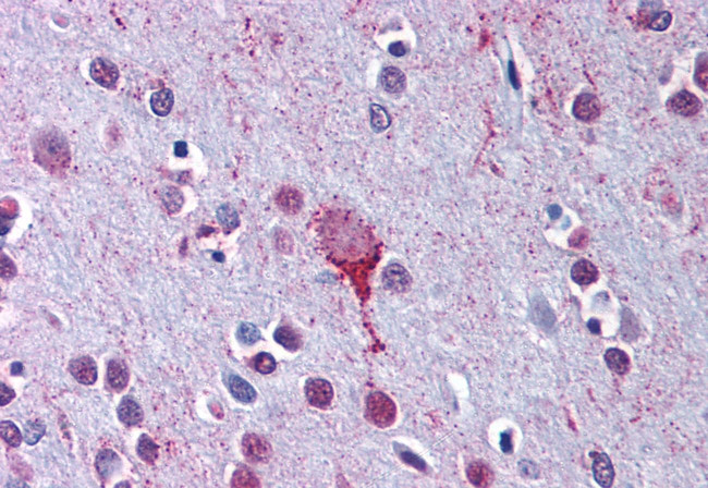 LPAR4 Antibody in Immunohistochemistry (Paraffin) (IHC (P))