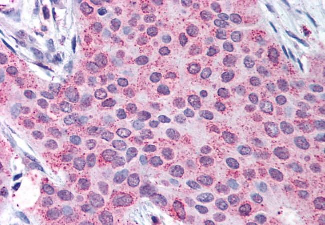 MMP13 Antibody in Immunohistochemistry (Paraffin) (IHC (P))