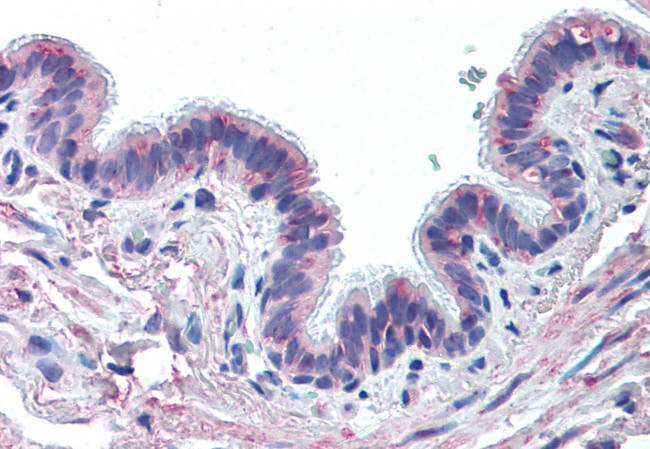 MUC13 Antibody in Immunohistochemistry (Paraffin) (IHC (P))