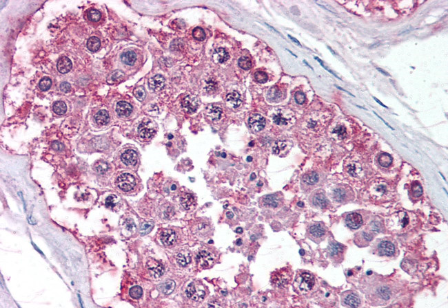 NR0B1 Antibody in Immunohistochemistry (Paraffin) (IHC (P))