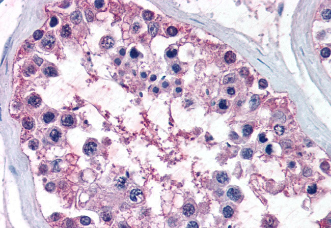 NR0B1 Antibody in Immunohistochemistry (Paraffin) (IHC (P))