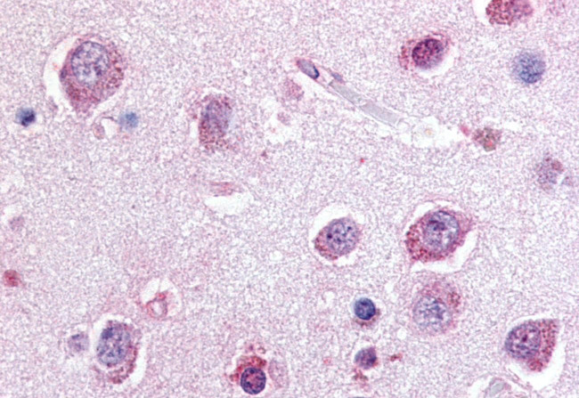 P2Y8 Antibody in Immunohistochemistry (Paraffin) (IHC (P))