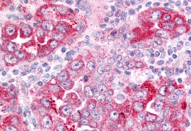 PTGES Antibody in Immunohistochemistry (Paraffin) (IHC (P))